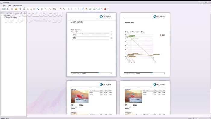 دانلود KLONK Image Measurement 2024.2.6.0 - دانلود اندازه گیری اجسام موجود در عکس - سافت گذر